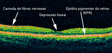 Detalhe de algumas camadas da retina.